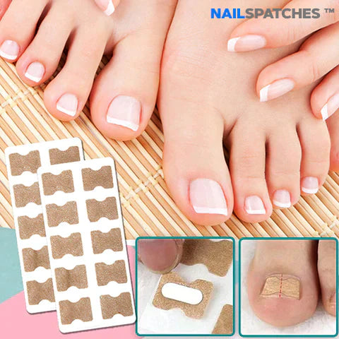 NailSpatches™| OFERTA 3x1 🎁